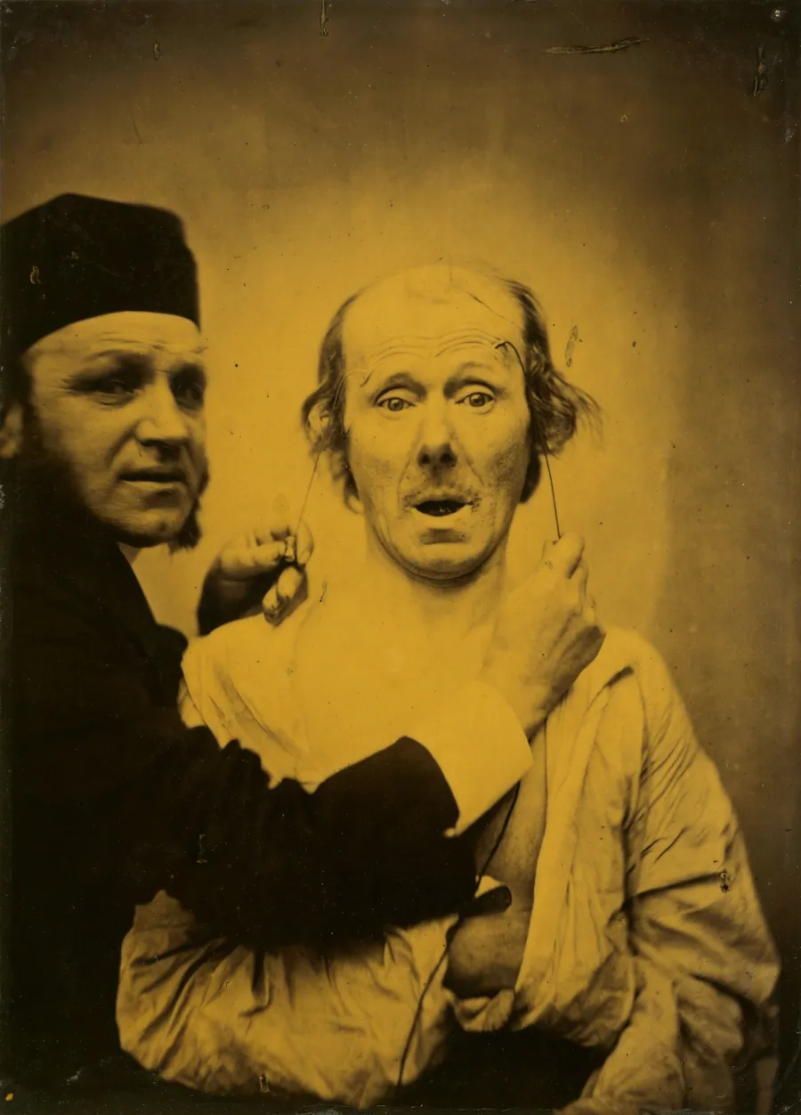 Surprise by Guillaume-Benjamin-Amant Duchenne (de Boulogne)