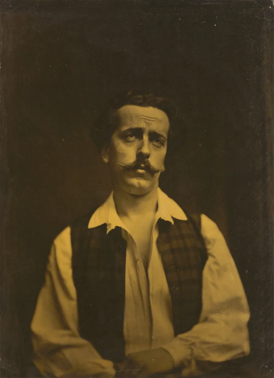 Painful recollection or painful thoughts by Guillaume-Benjamin-Amant Duchenne (de Boulogne)