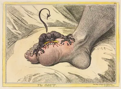 The Gout