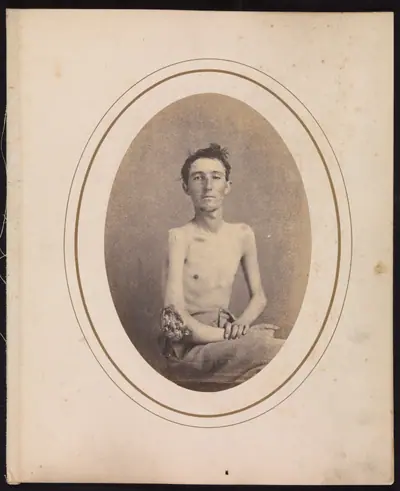 Private James H. Stokes, Company H, 185th New York Volunteers