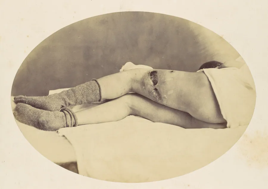 Judson C. Albright by Reed Brockway Bontecou