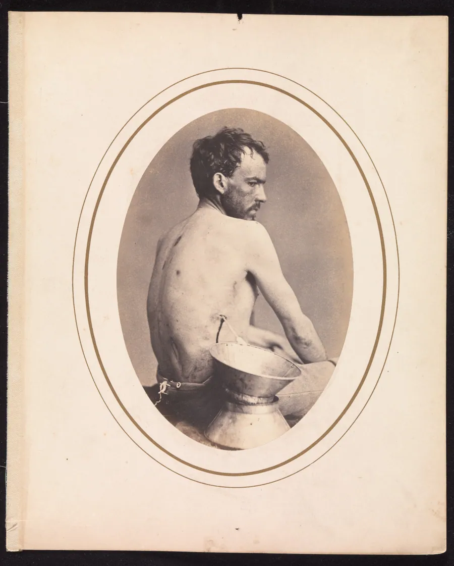 Corporal Israel Spotts, Company G, 200th Pennsylvania Volunteers by Reed Brockway Bontecou