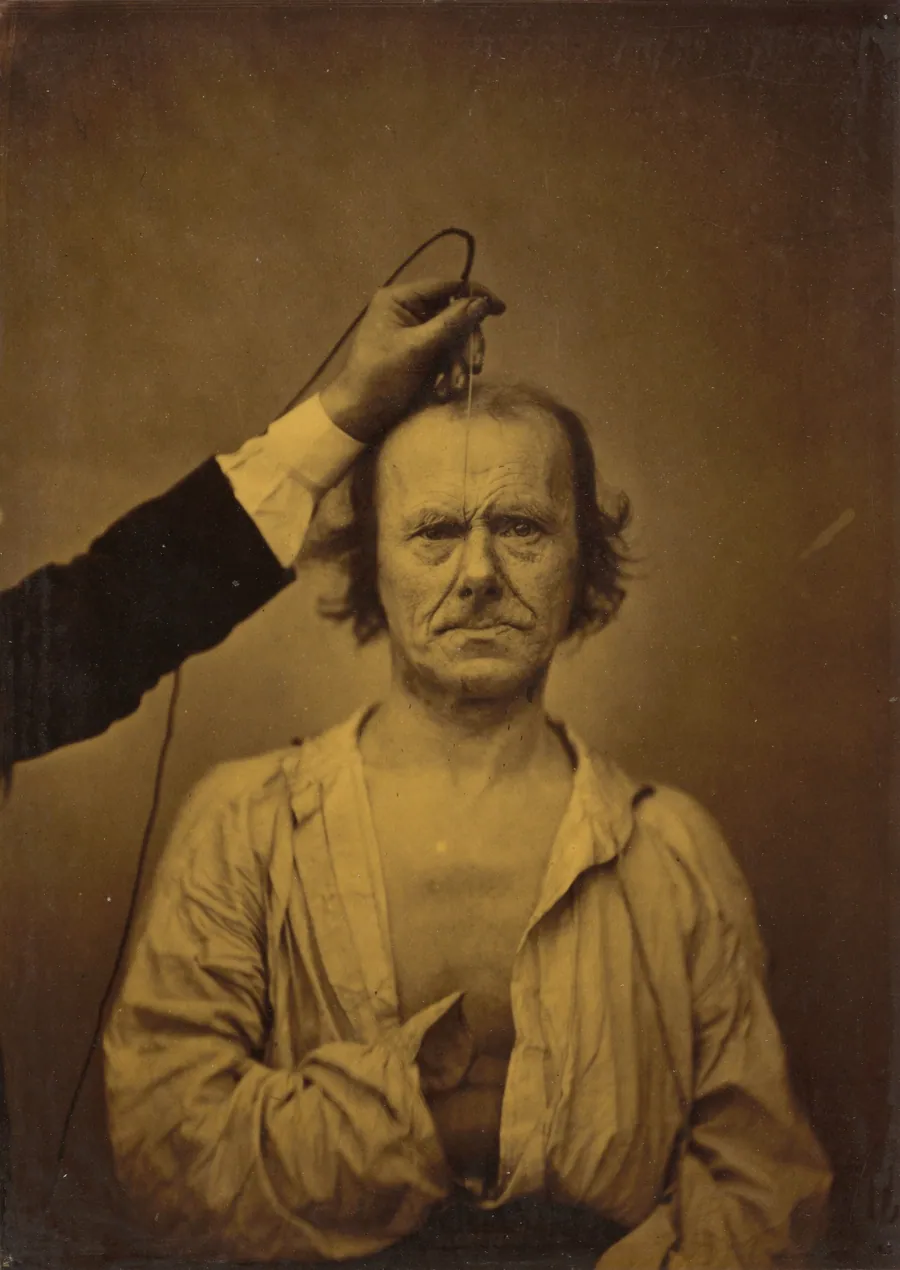 Attention (left); Severity, aggression (right) by Guillaume-Benjamin-Amant Duchenne (de Boulogne)