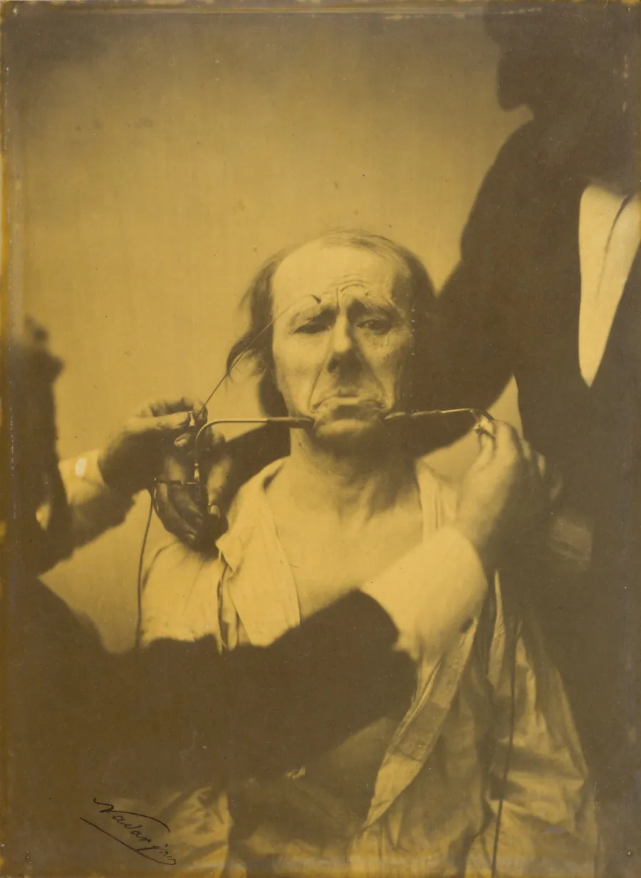 Pain and despair by Guillaume-Benjamin-Amant Duchenne (de Boulogne)