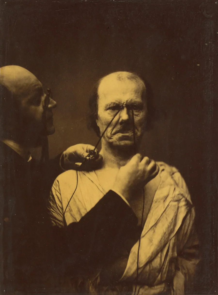 Aggression, wickedness by Guillaume-Benjamin-Amant Duchenne (de Boulogne)