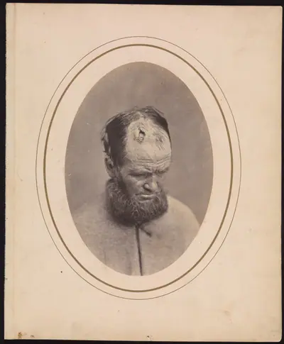 Private John Parkhurst, Company E, Second New York Heavy Artillery