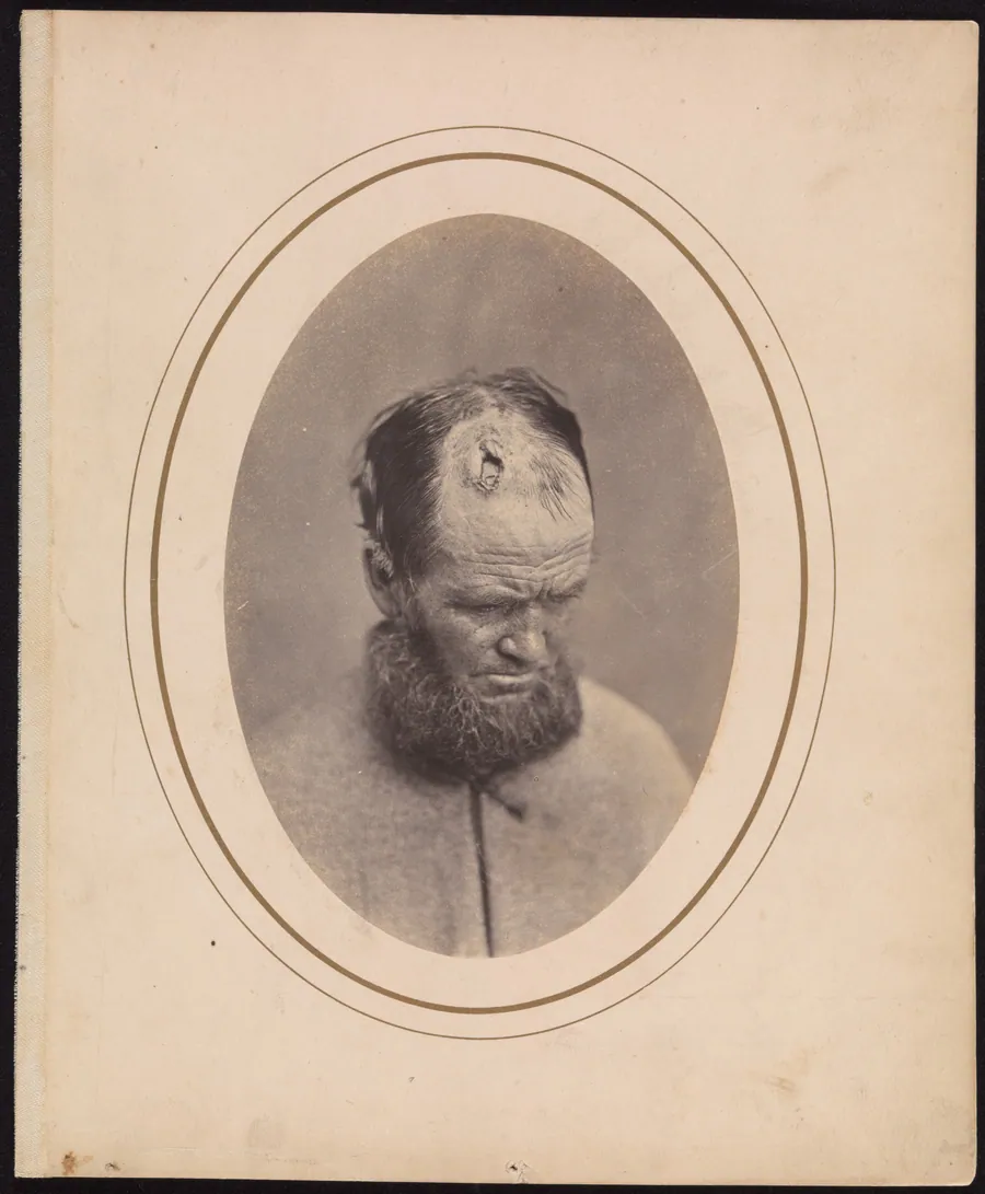 Private John Parkhurst, Company E, Second New York Heavy Artillery by Reed Brockway Bontecou