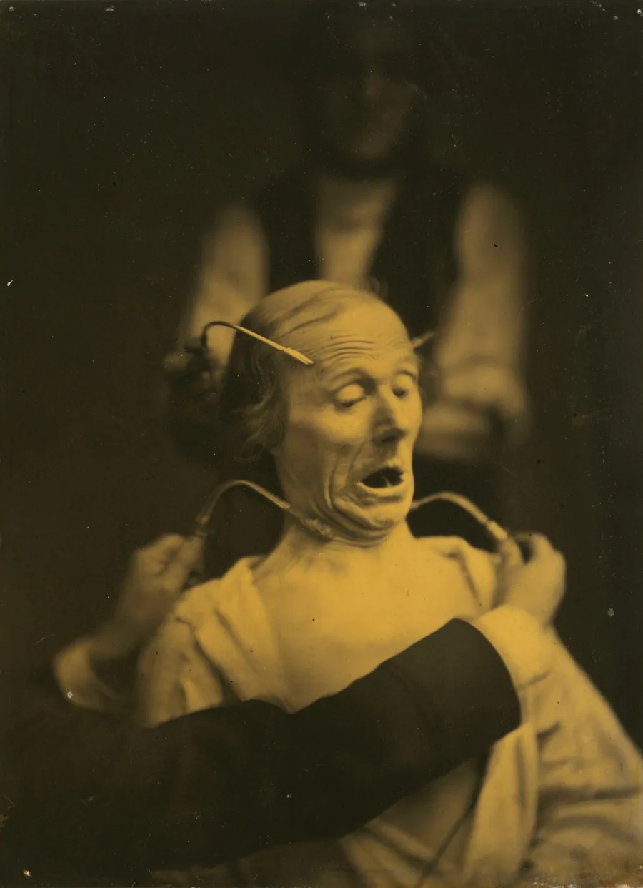 Expression of terror by Guillaume-Benjamin-Amant Duchenne (de Boulogne)
