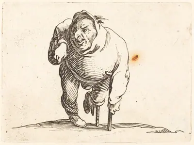 Cripple with Crutch and Wooden Leg