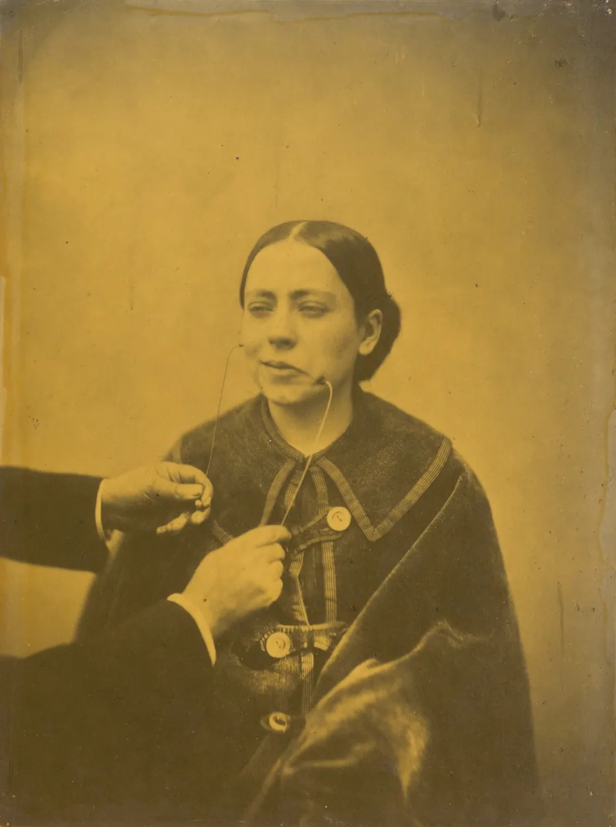 Scornful disgust (left); Scornful laughter (right) by Guillaume-Benjamin-Amant Duchenne (de Boulogne)