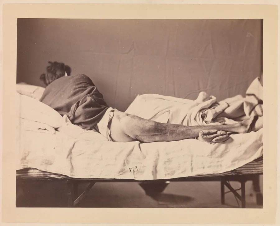 Private George Ruoss, Co. G, 7th New York Volunteers by Reed Brockway Bontecou