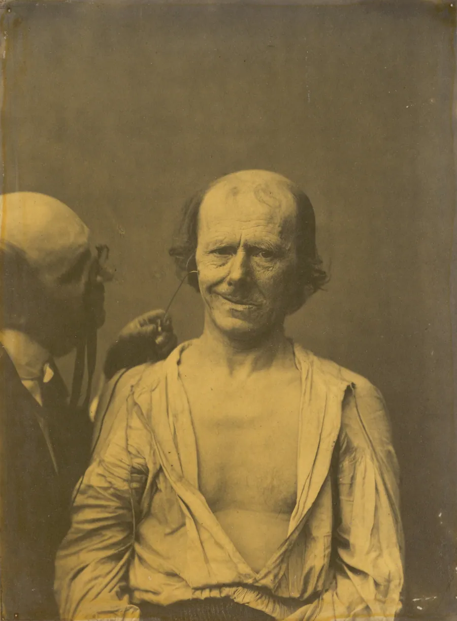 A relaxed face (left); False joy or laughter (right) by Guillaume-Benjamin-Amant Duchenne (de Boulogne)