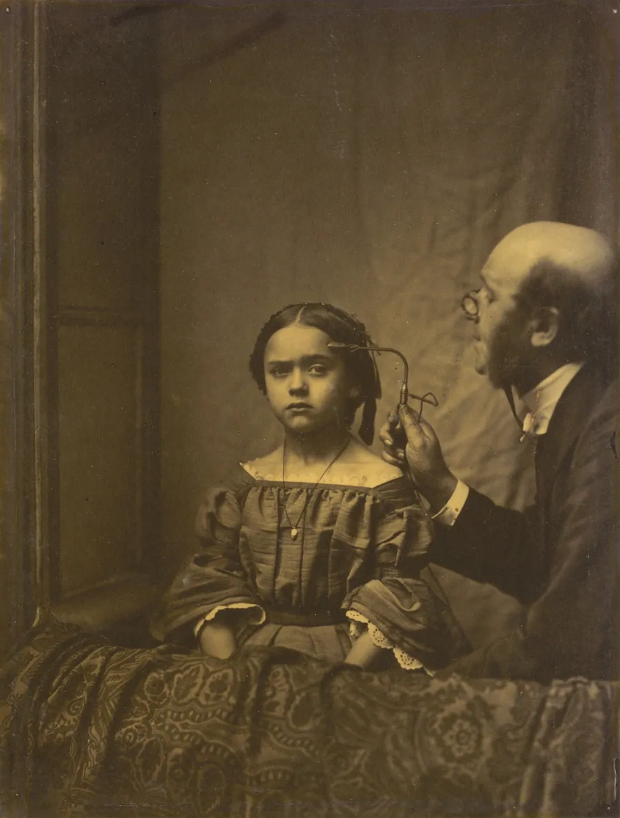 The muscle of attention (left); Eyebrow contraction due to bright light (right) by Guillaume-Benjamin-Amant Duchenne (de Boulogne)
