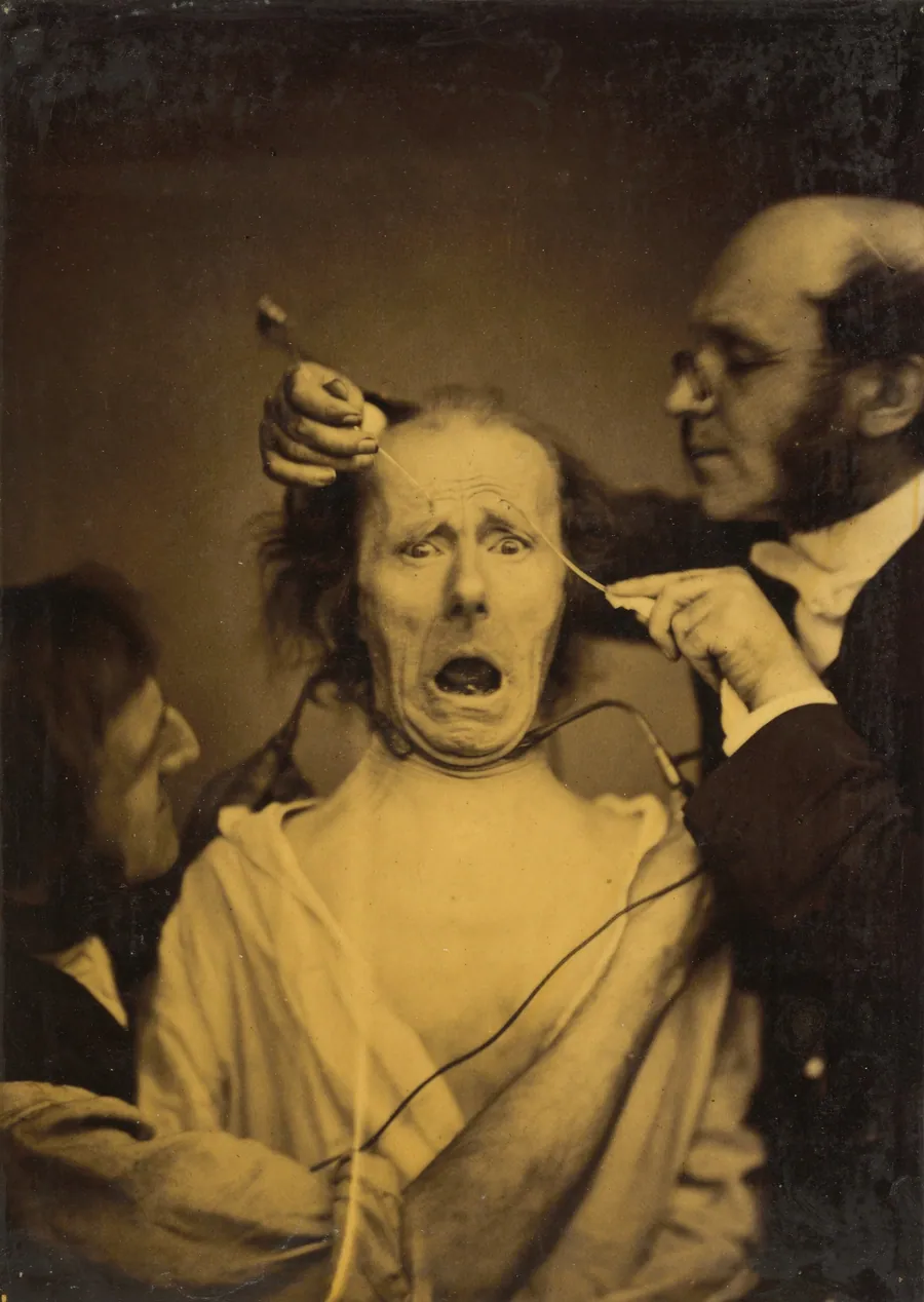 Terror mixed with pain, torture by Guillaume-Benjamin-Amant Duchenne (de Boulogne)