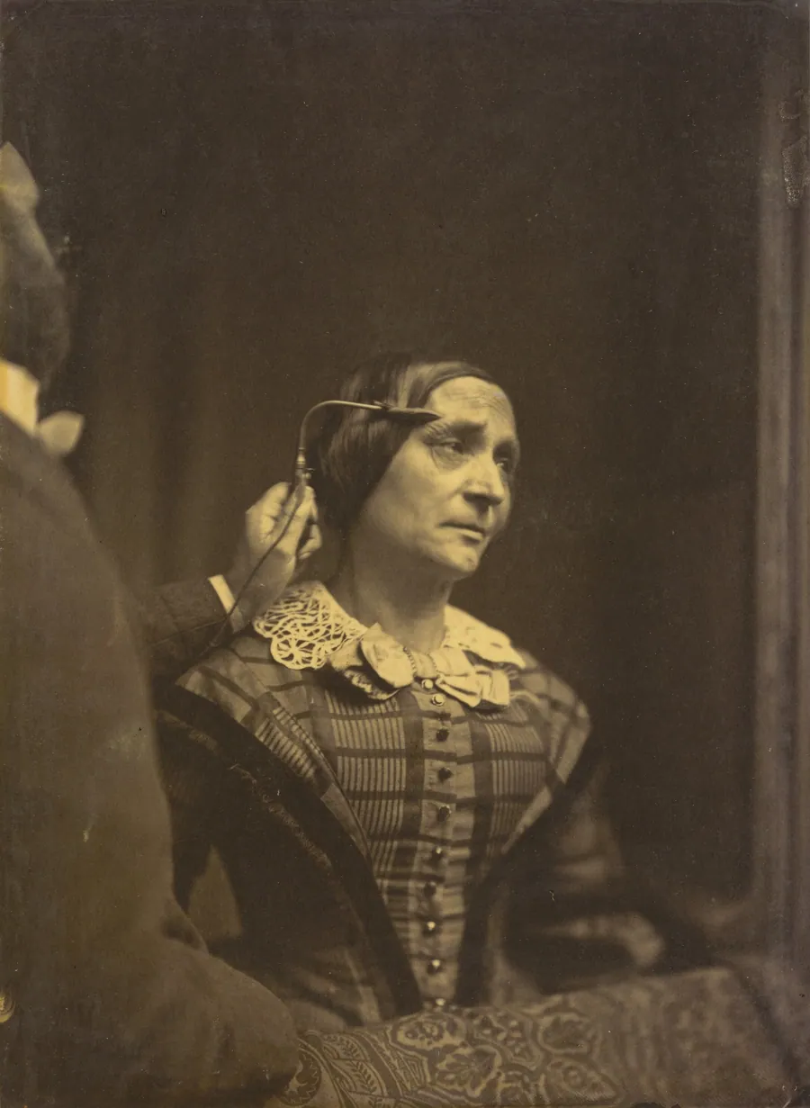Attention, attentive gaze (left); Painful attention (right) by Guillaume-Benjamin-Amant Duchenne (de Boulogne)