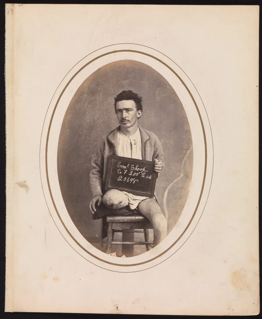 Private Samuel Shoop, Company F, 200th Pennsylvania Infantry by Reed Brockway Bontecou
