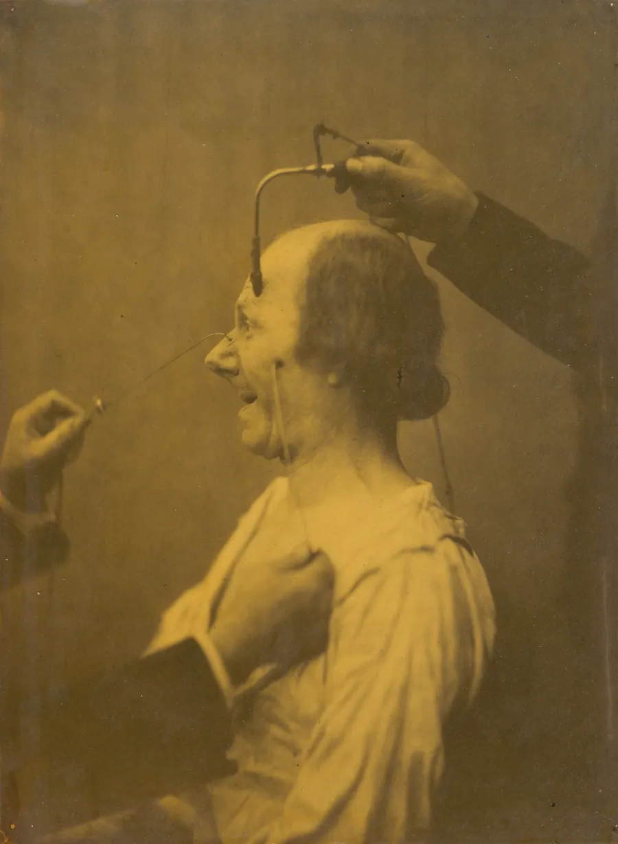 The attention attracted by an object that provokes lascivious ideas and desires by Guillaume-Benjamin-Amant Duchenne (de Boulogne)