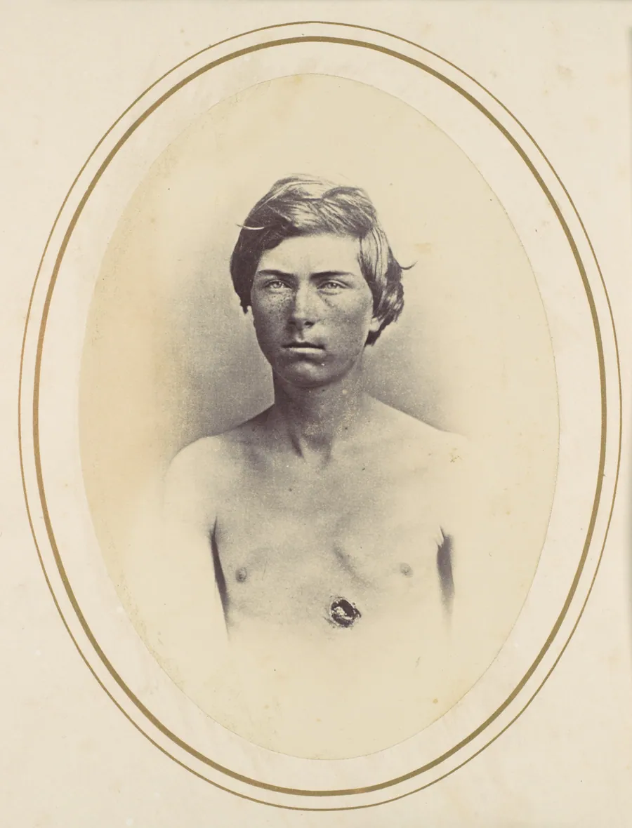 Frederick A. Bentley by Reed Brockway Bontecou
