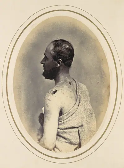 Henry Yon