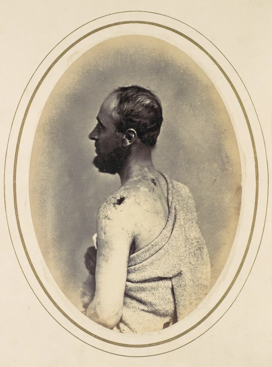 Henry Yon by Reed Brockway Bontecou