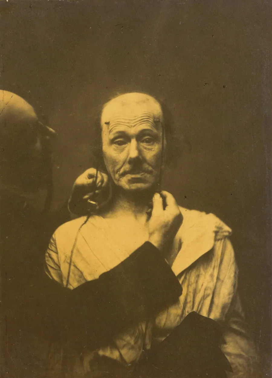 Attention by Guillaume-Benjamin-Amant Duchenne (de Boulogne)