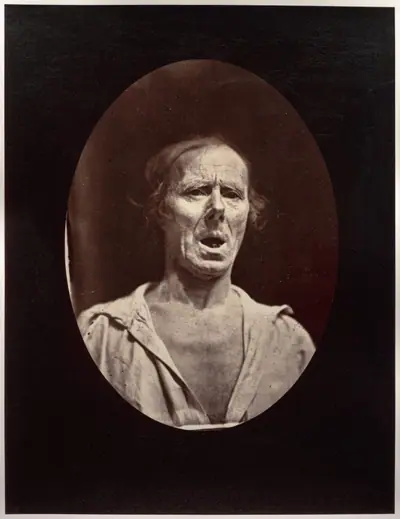Figure 54: Abaissement volontaire de la mâchoire inférieure: mouvement inexpressif