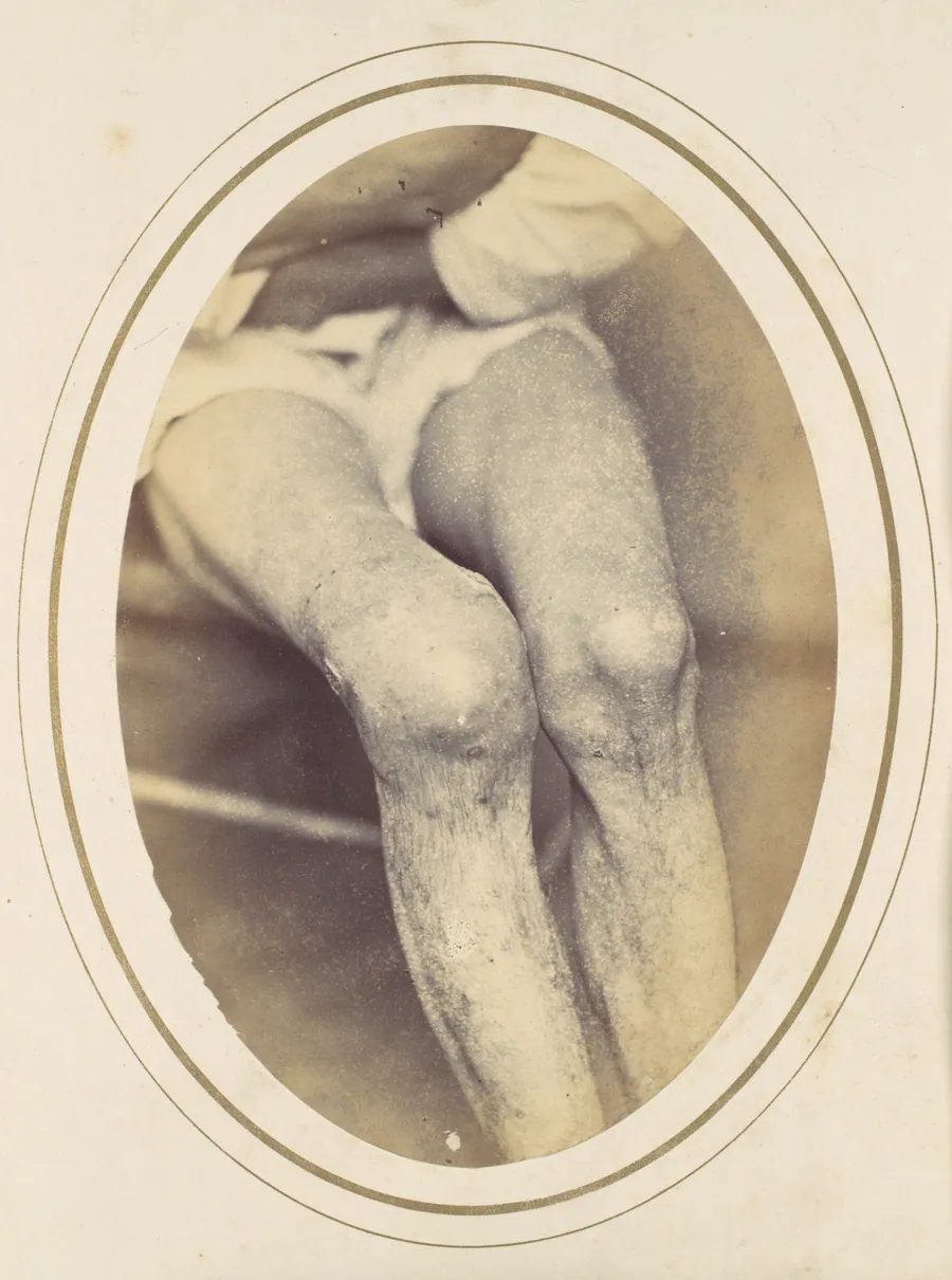 Frederick Hohmann by Reed Brockway Bontecou